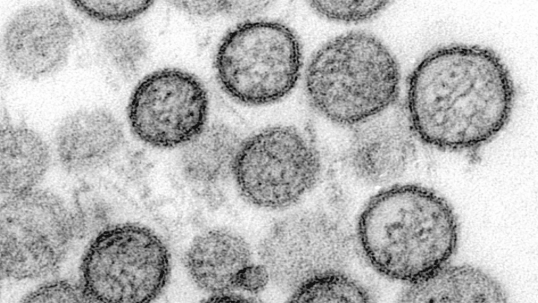 BRIN Jelaskan Risiko Penularan Hantavirus usai Temuan Kasus di DKI